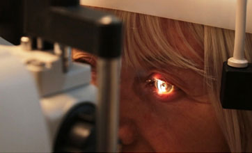 Cataract Eye Examination